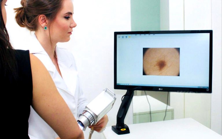 Dermatologista Dra. Fernanda Trindade - Clínica em Belo Horizonte | Dermatologia Clínica - Dermatoscopia Digital